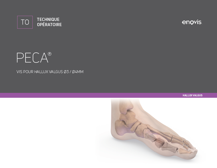 Technique chirurgicale PECA