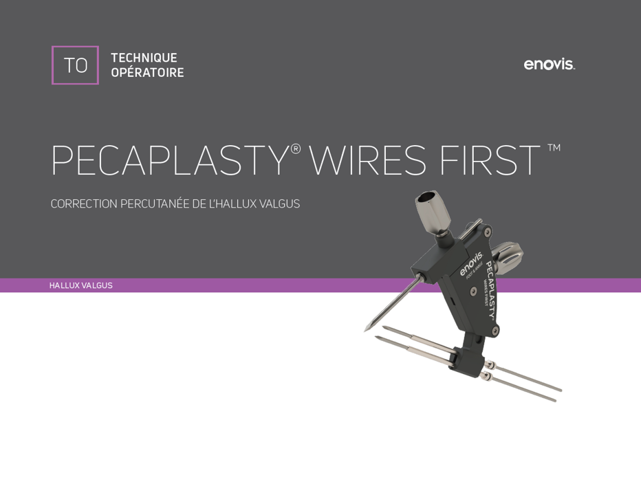 Technique chirurgicale Pecaplasty Wires First